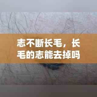 志不断长毛,长毛的志能去掉吗?