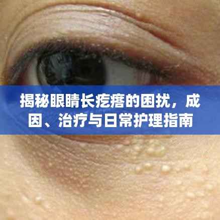 揭秘眼睛长疙瘩的困扰,成因、治疗与日常护理指南